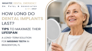 How Long Do Dental Implants Last?