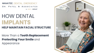 How Dental Implants Help Maintain Facial Structure